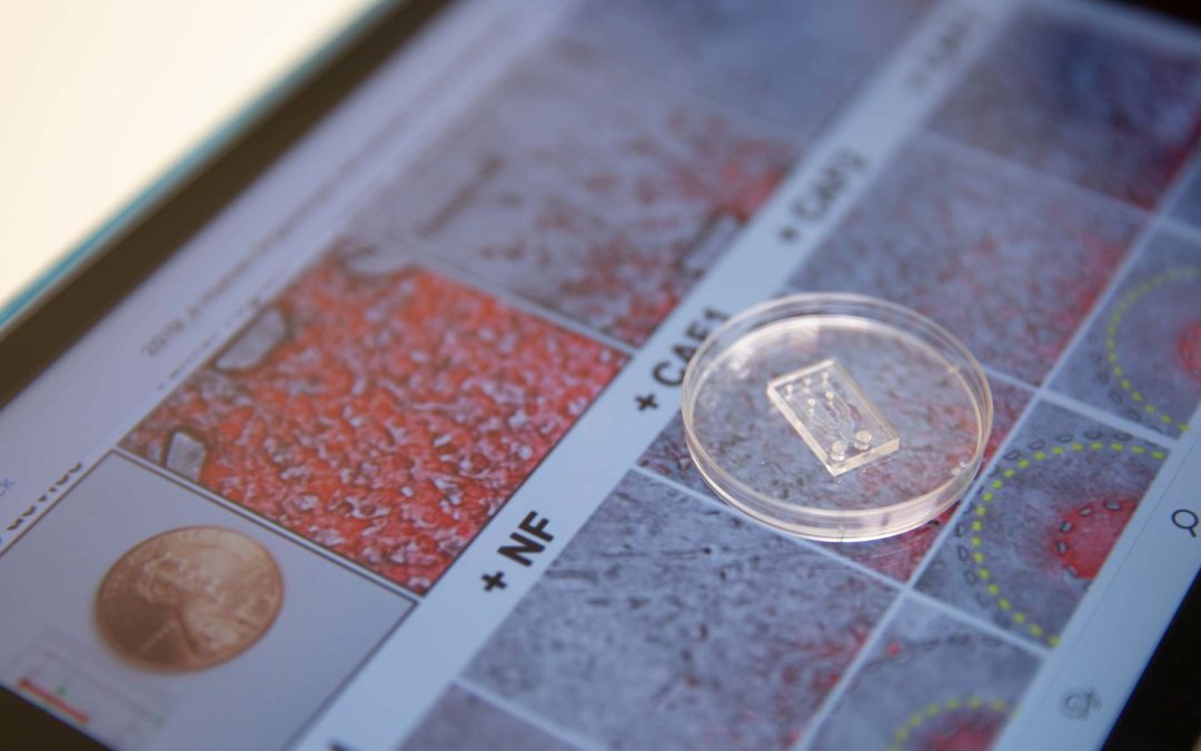 A microfluidic chip, which looks like a clear plastic microchip, sits on top of images of cancer cells and fibroblast cells